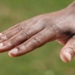 Close-up view of a relaxed hand with a blurred green background.